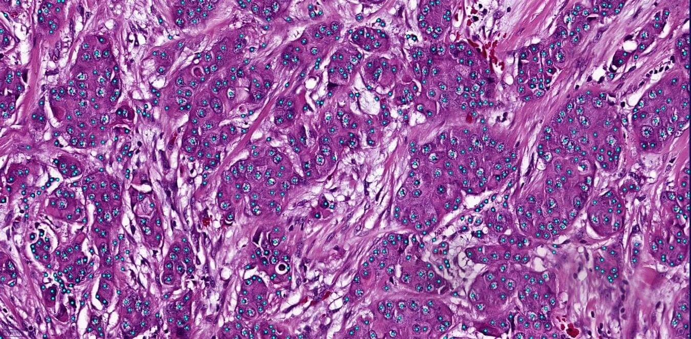 Nuclei Detection